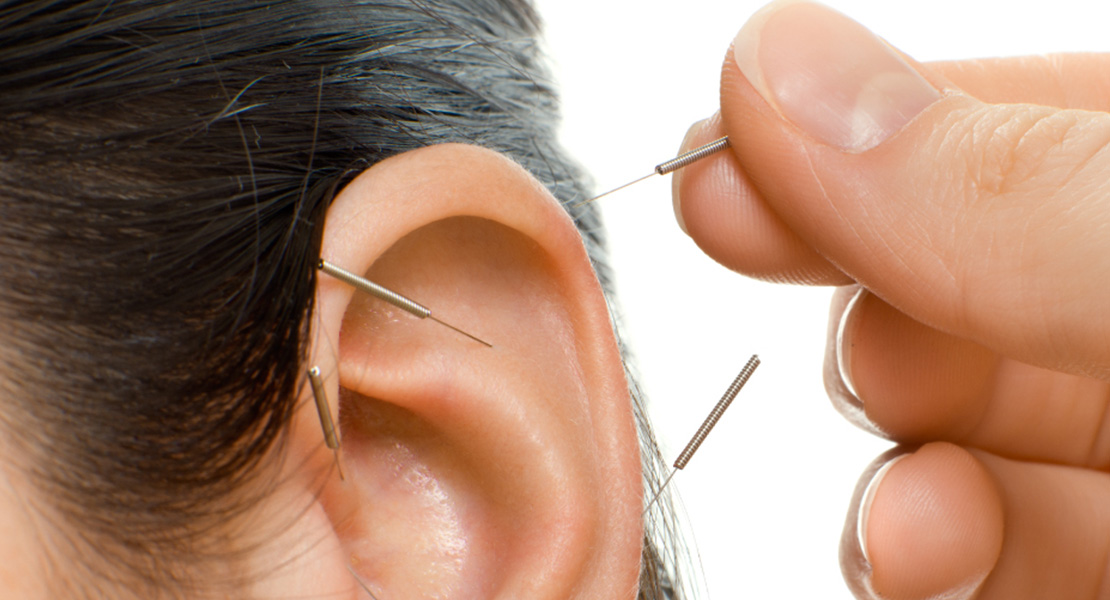 Fülakupunktúra